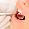 7 Health Issues Revealed by Your Teeth